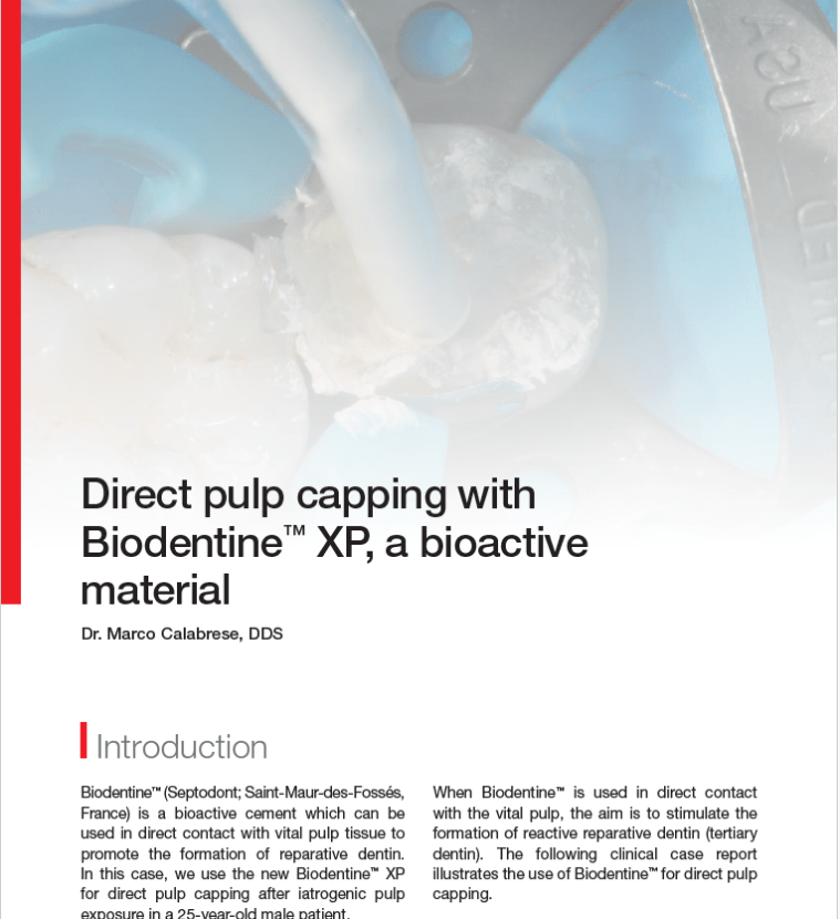 Direct pulp capping with Biodentine® XP, a bioactive material